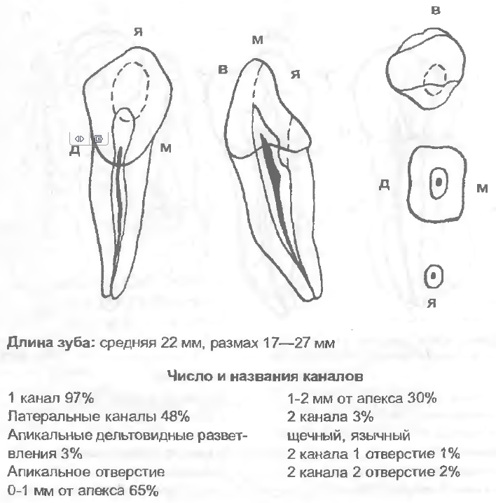 Верхний 5 зуб канал