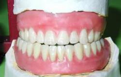 Зуби людини анатомія