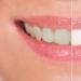 Отбеливание зубов: виды и их особенности