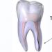 Трещины на зубной эмали: причины, симптомы и лечение
