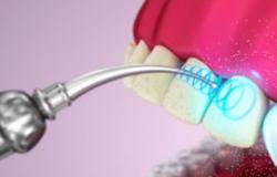 Ультразвуковая чистка зубов Как чистят зубы ультразвуком