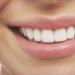 Выравнивание зубов: как не потратить время и деньги зря